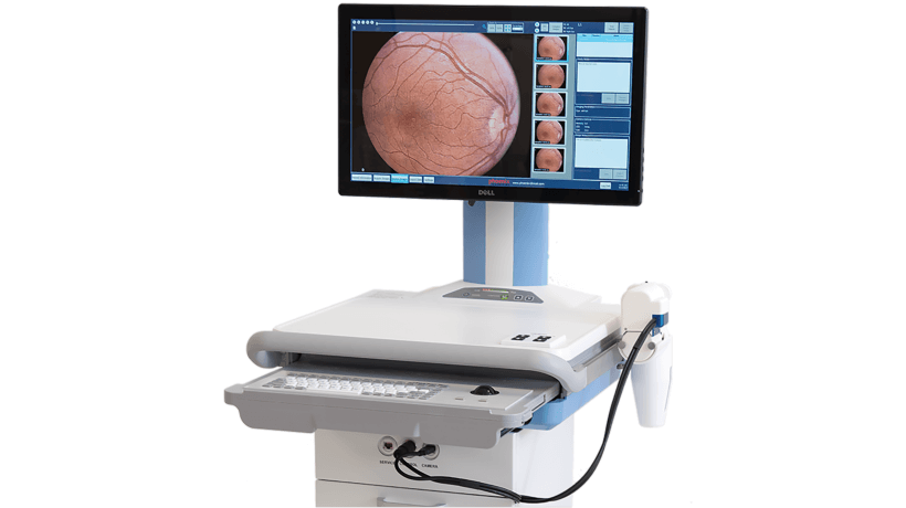 P.T.G. Partners with Advantech for Support in the Development of a Revolutionary Retinal Imaging Medical Cart